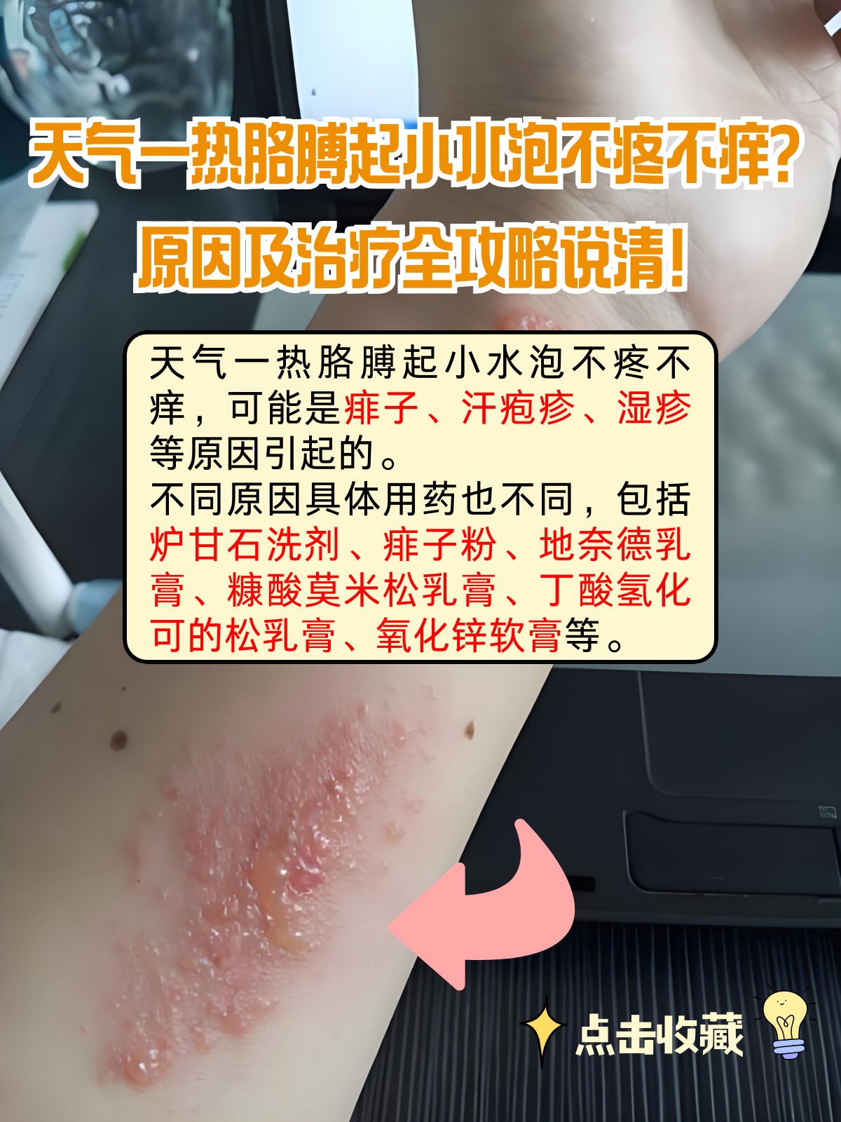 天气一热胳膊起小水泡不疼不痒?原因及治疗全攻略说清!