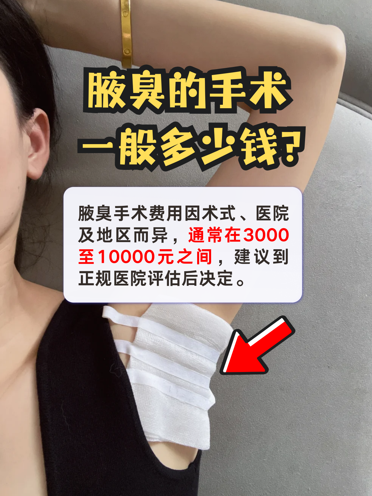 在医院做狐臭手术需要多少钱(在医院做狐臭手术需要多少钱费用)