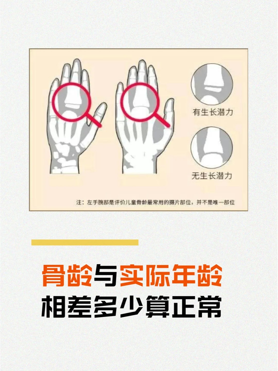 骨龄与年龄差多少算正常?影响长高吗?