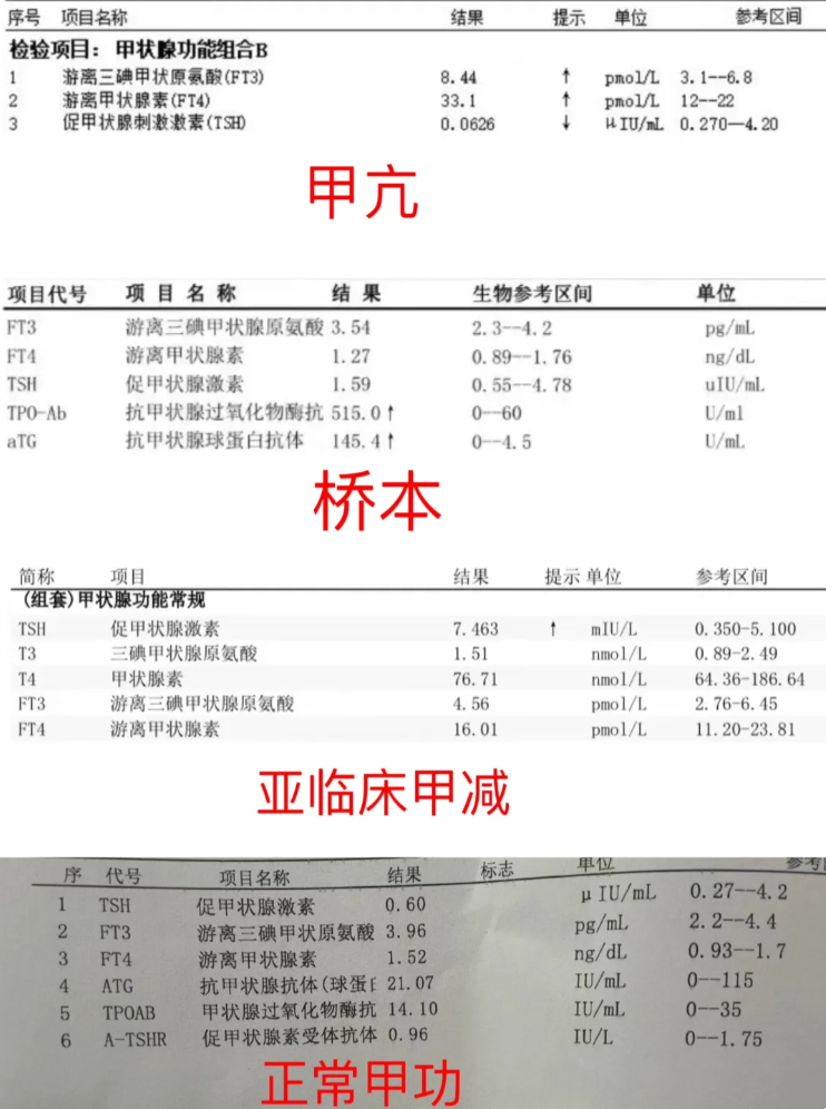 甲状腺化验单模板图片