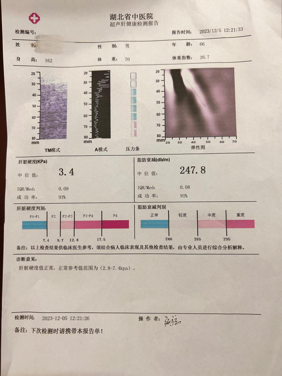 槟榔肝内可见图片