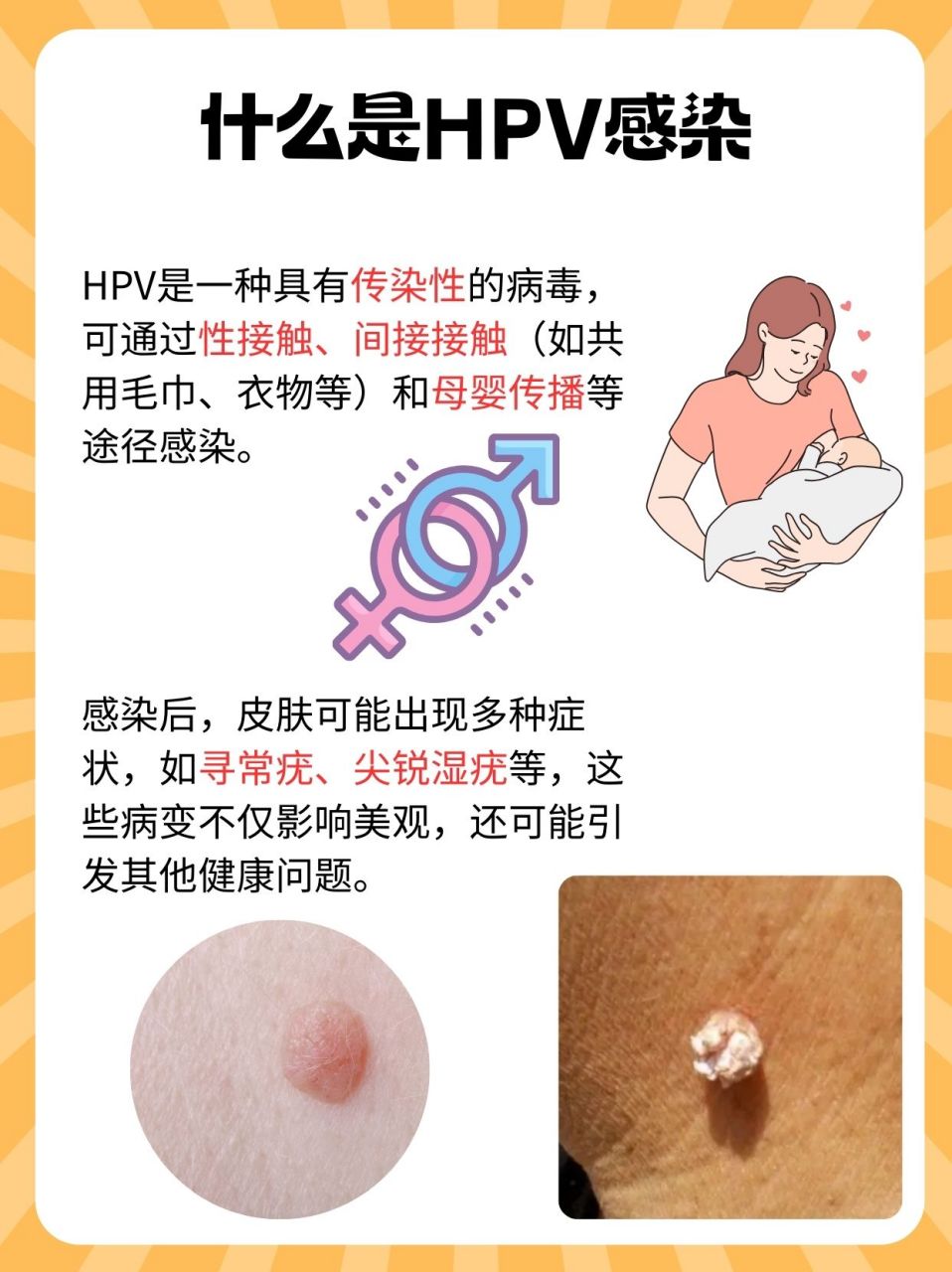 HPV是怎么感染的 早期图片