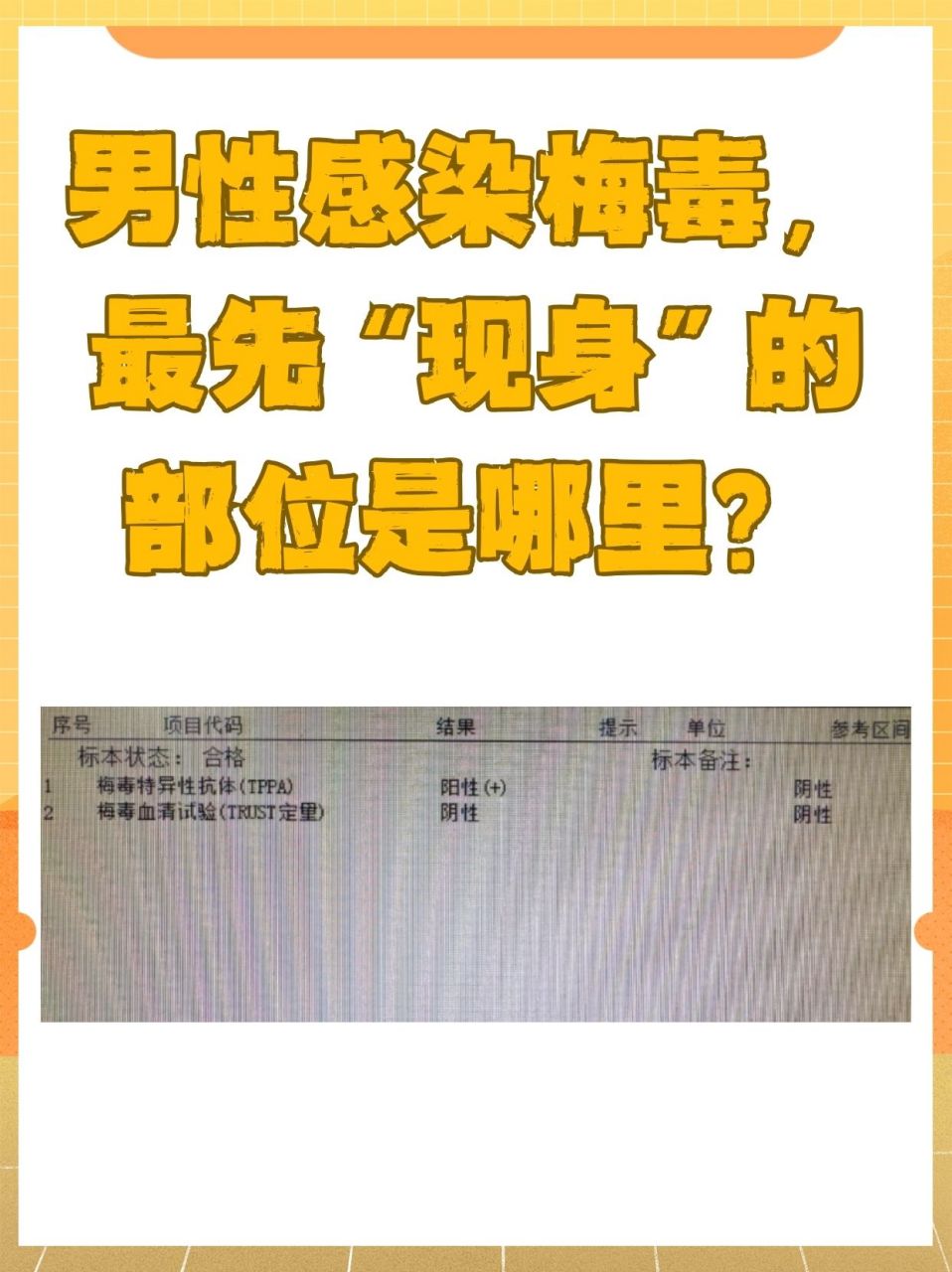 鸡儿中梅毒是什么样图片