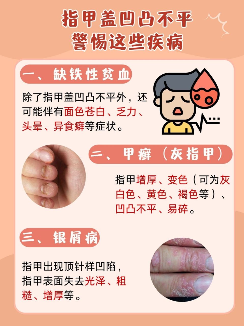 手指甲盖的状态常常被我们忽略,但当它出现凹凸不平的情况时,就需要