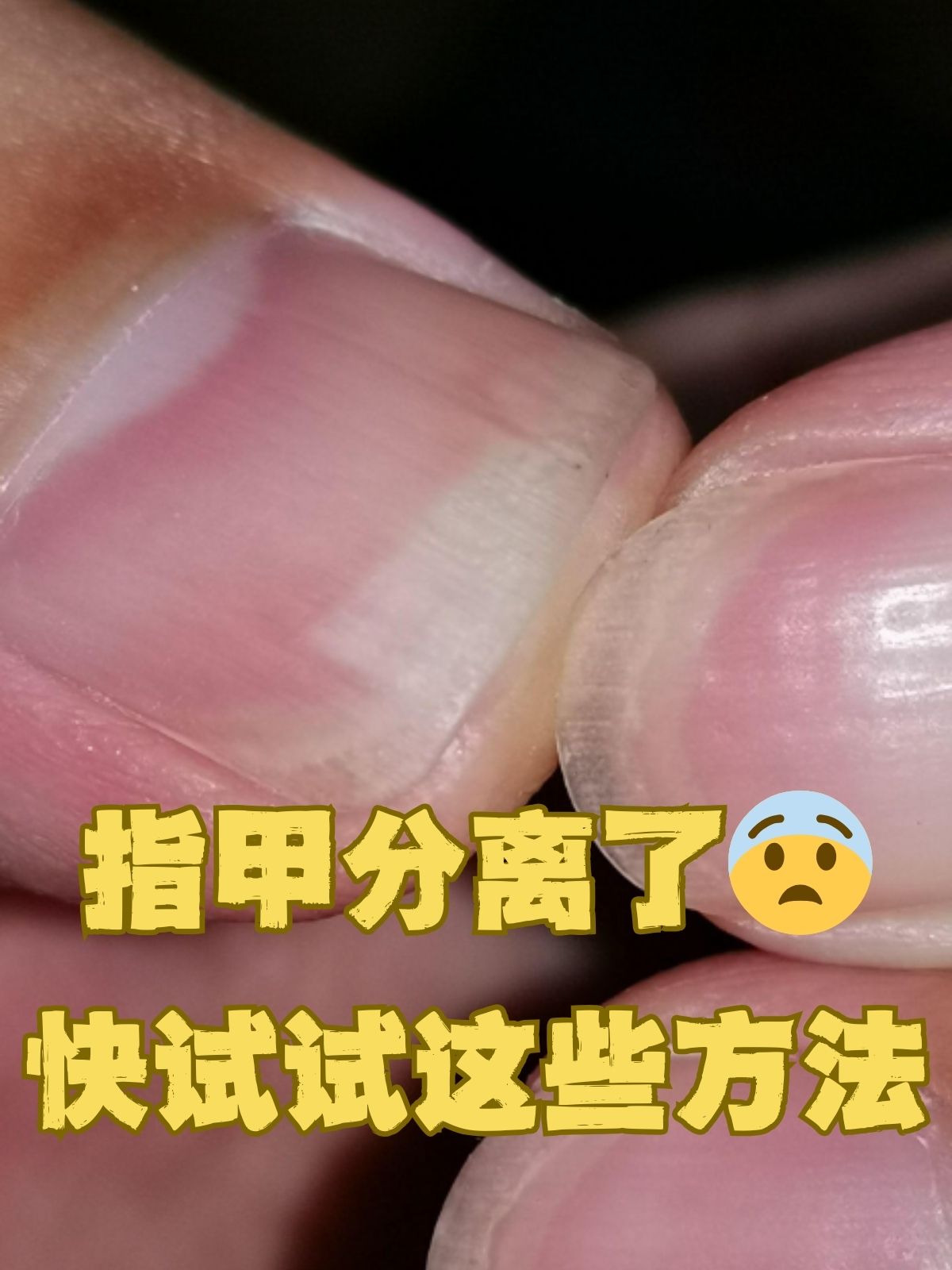 指甲分层图片前端图片