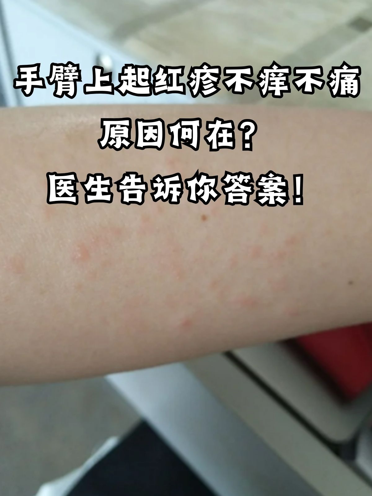 通常这种情况可能由多种原手臂发红胳膊上好多红疙瘩怎么回事身嗓长