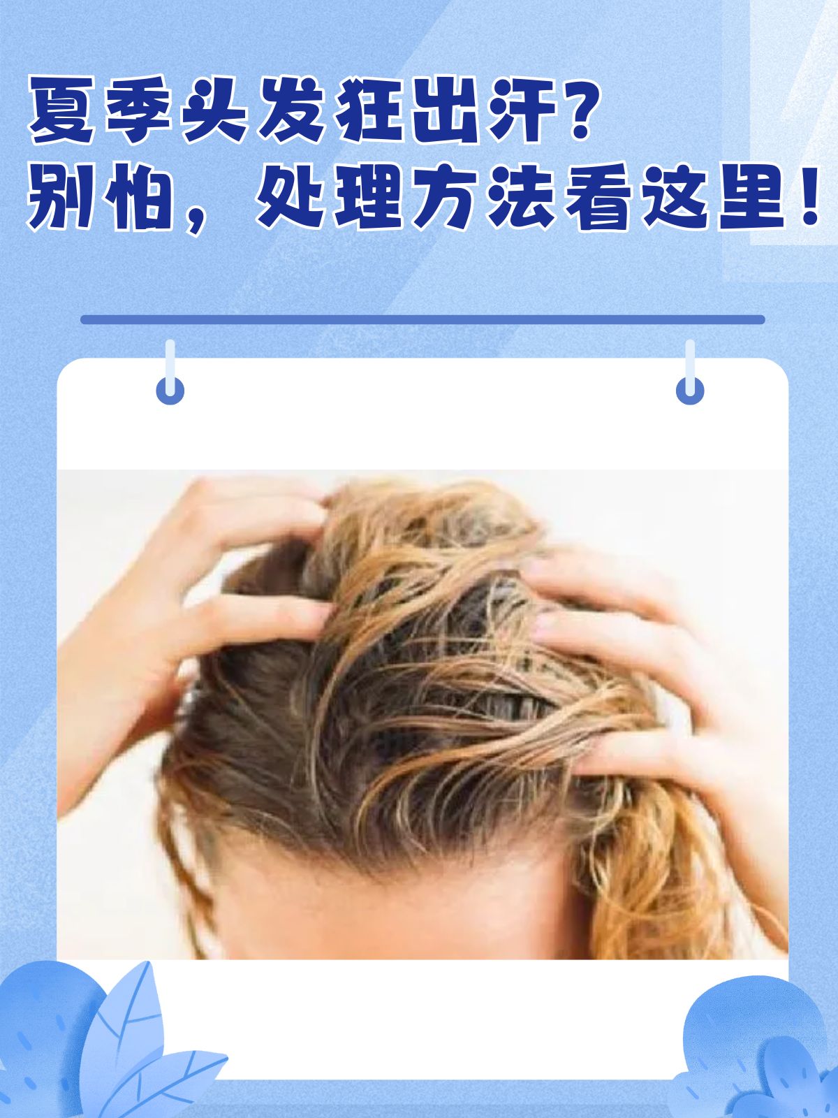 为什么头上出汗特别多