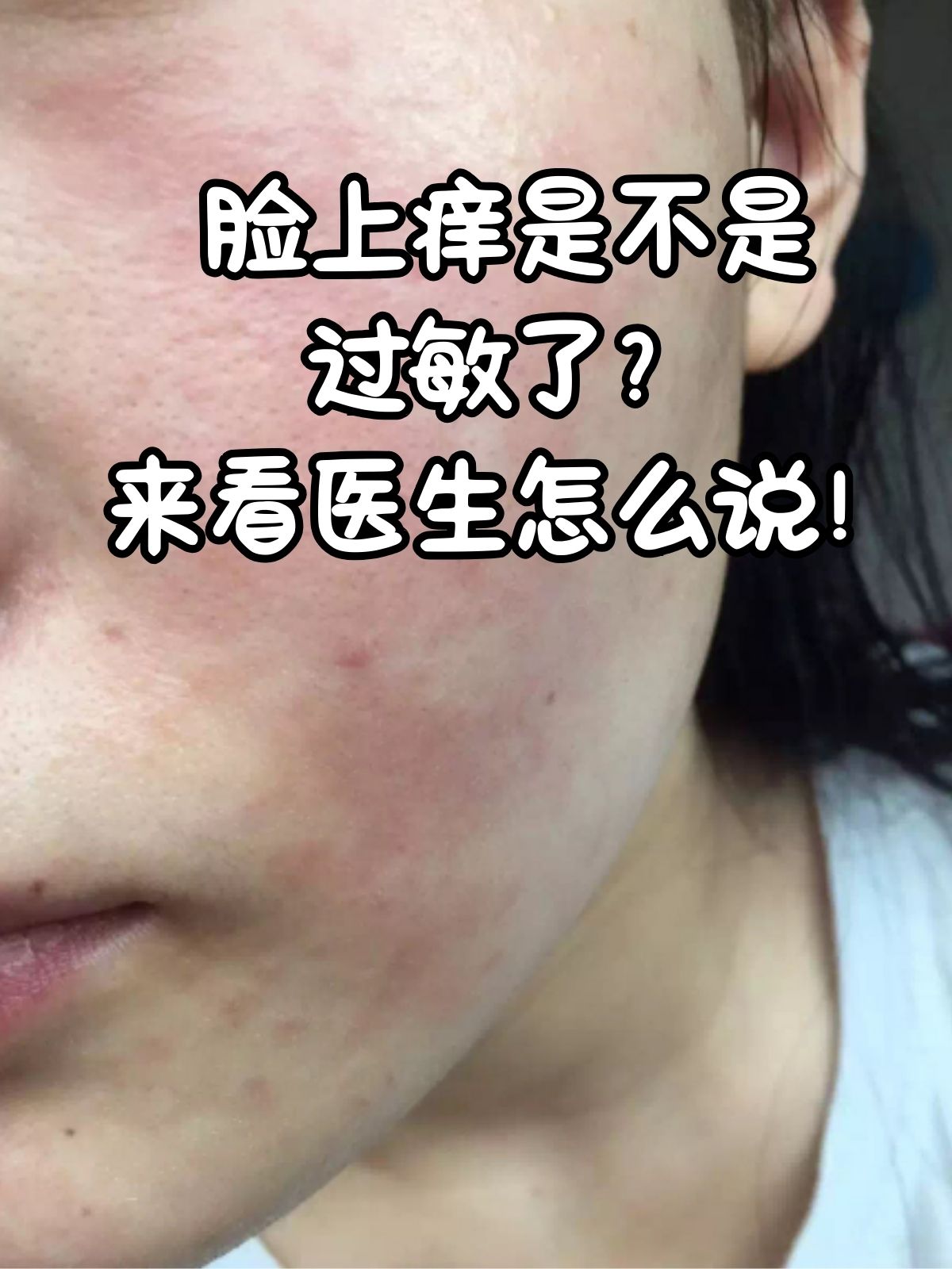 脸部瘙痒,这个看似不起眼的症状,实则可能是肌肤健康状态的一个重要