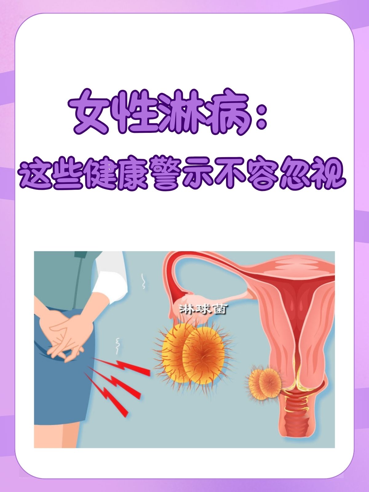 女人得性疾病什么症状图片