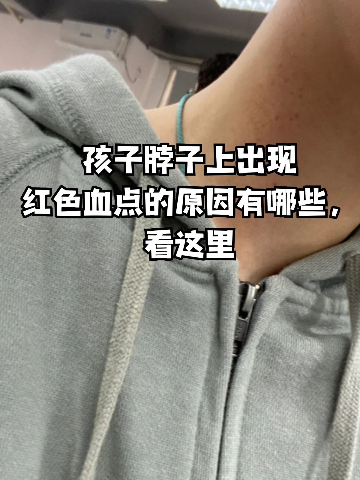 脖子上长了红血点图片图片