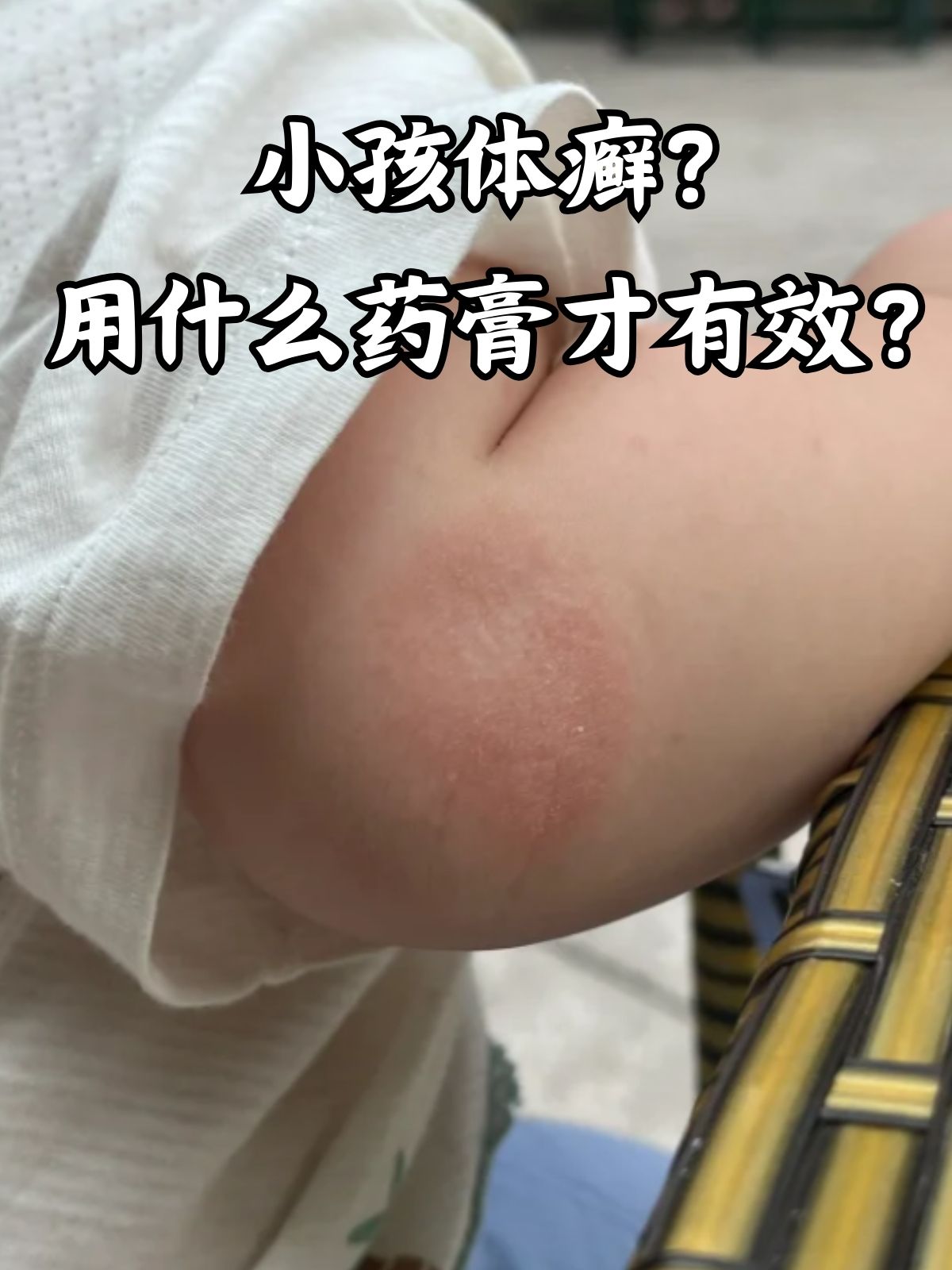 克霉唑乳膏的作用图片