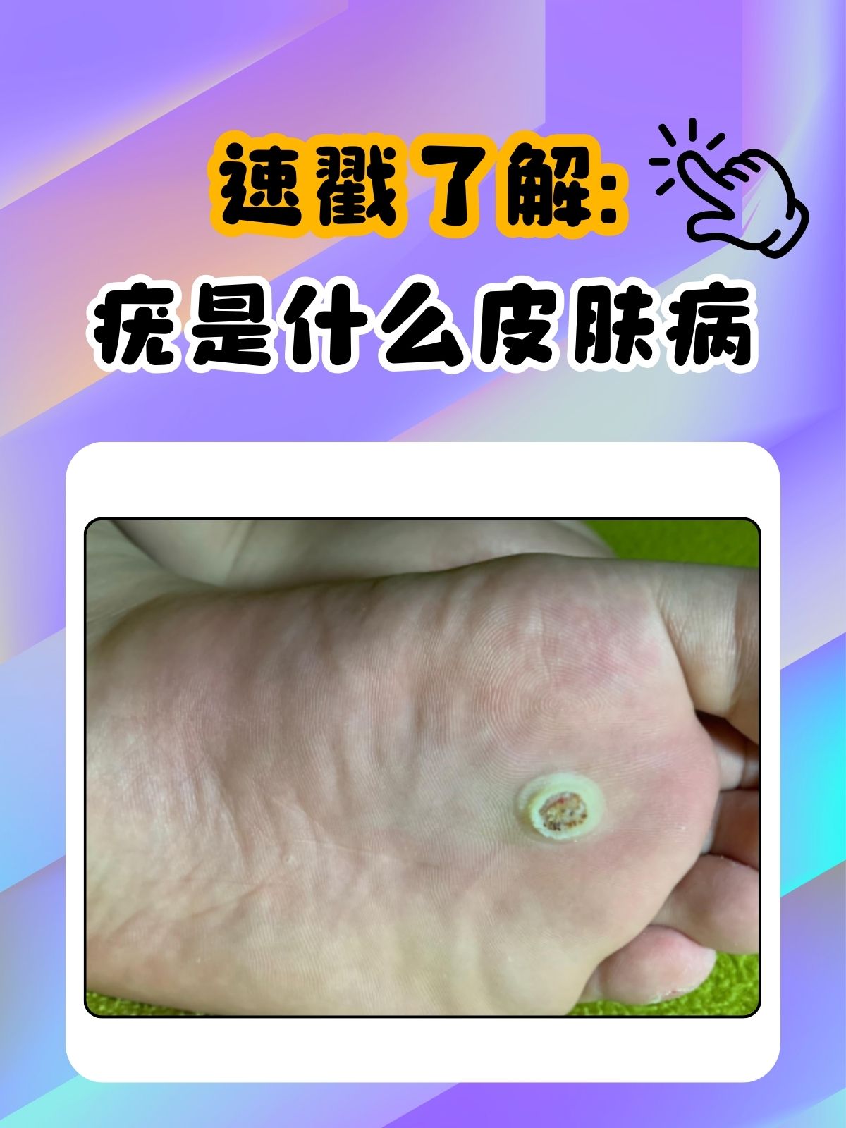 什么样的皮肤病最可怕