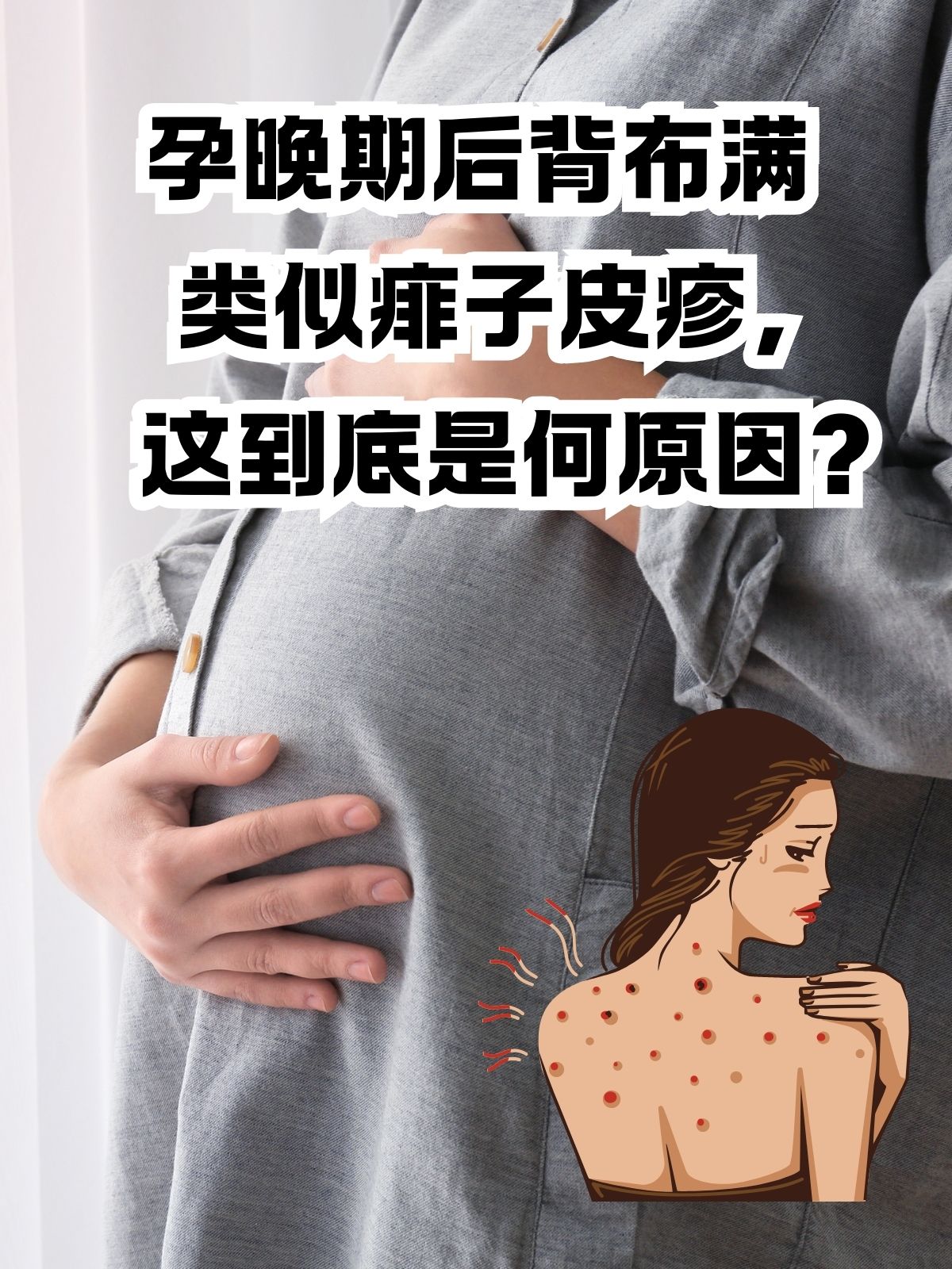 免疫出疹子要警惕孕妇晚期身上痒的图片大全出痱子的原因孕妈皮疹发红