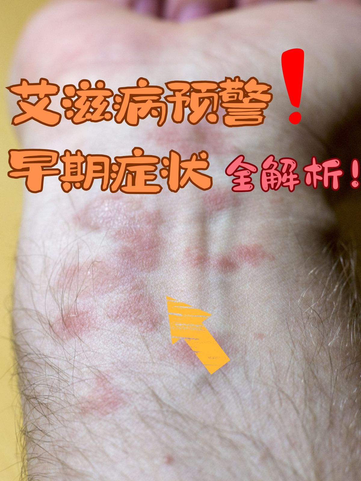 病毒感染症状严重表现