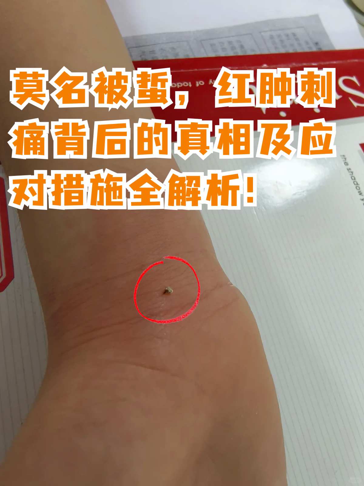 下面就给大家讲讲常济鄯湔萘嗽趺创硌罄弊诱萘 伤口图片海蜇蜇伤后