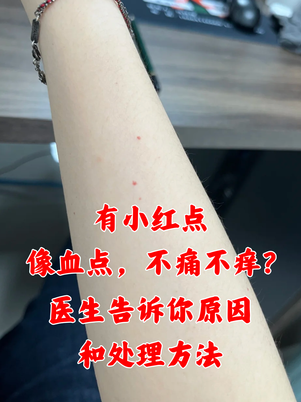 有小红点,像血点,不痛不痒?