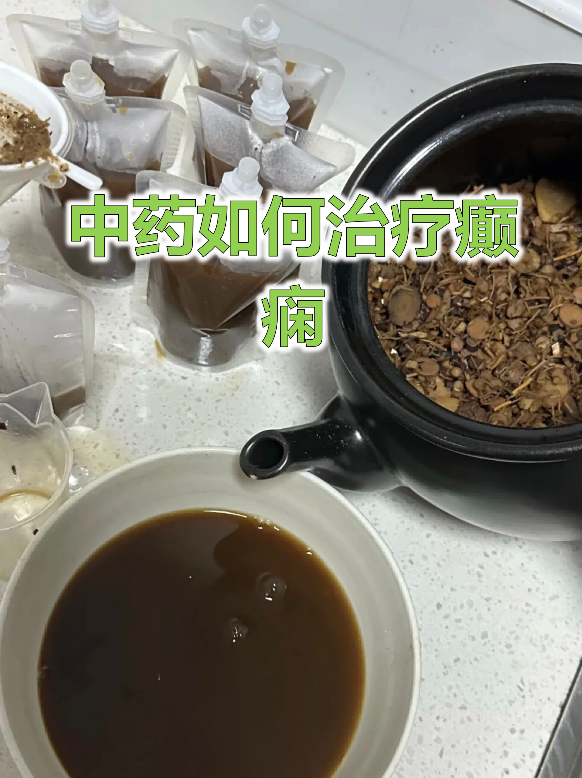 中药如何治疗癫痫