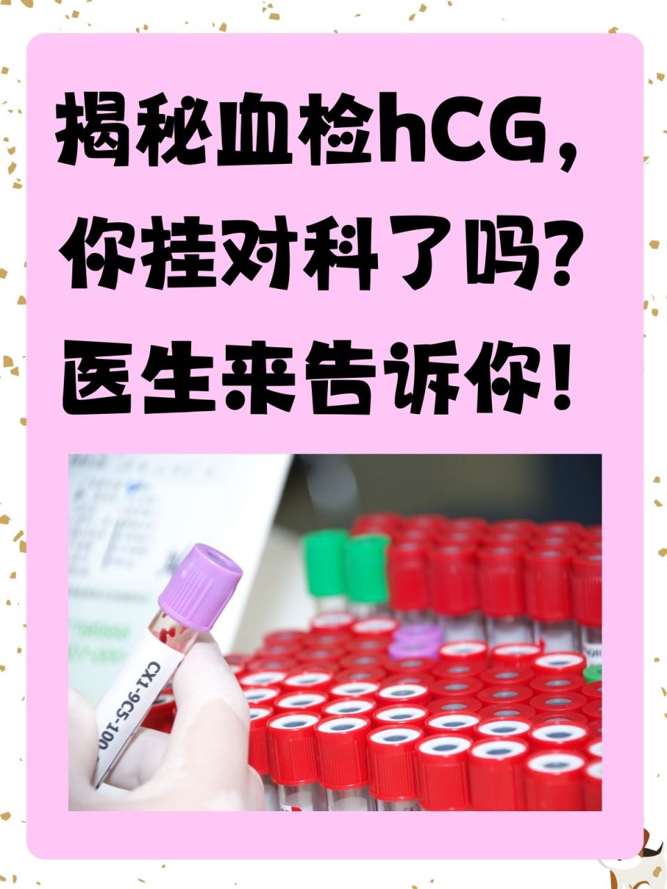 hcg血检挂号哪个科(hcg血检挂号哪个科室看)