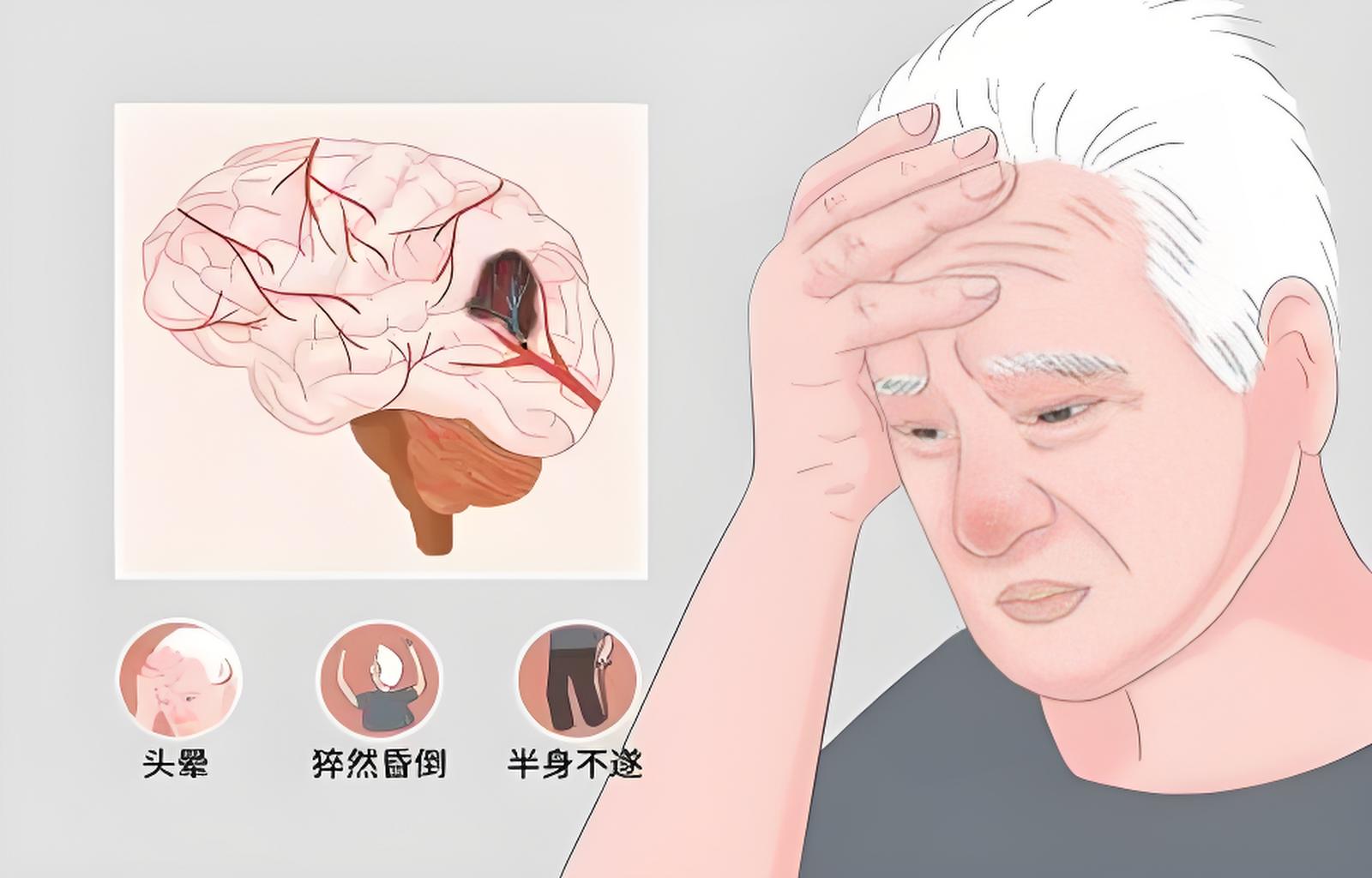 精神类头晕怎么办(精神方面引起的头晕)