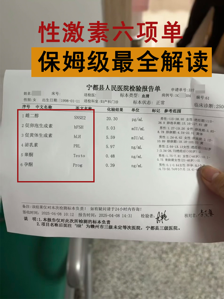 女性正常的卵泡激素值是多少(女性正常的卵泡激素值是多少呢)  第2张
