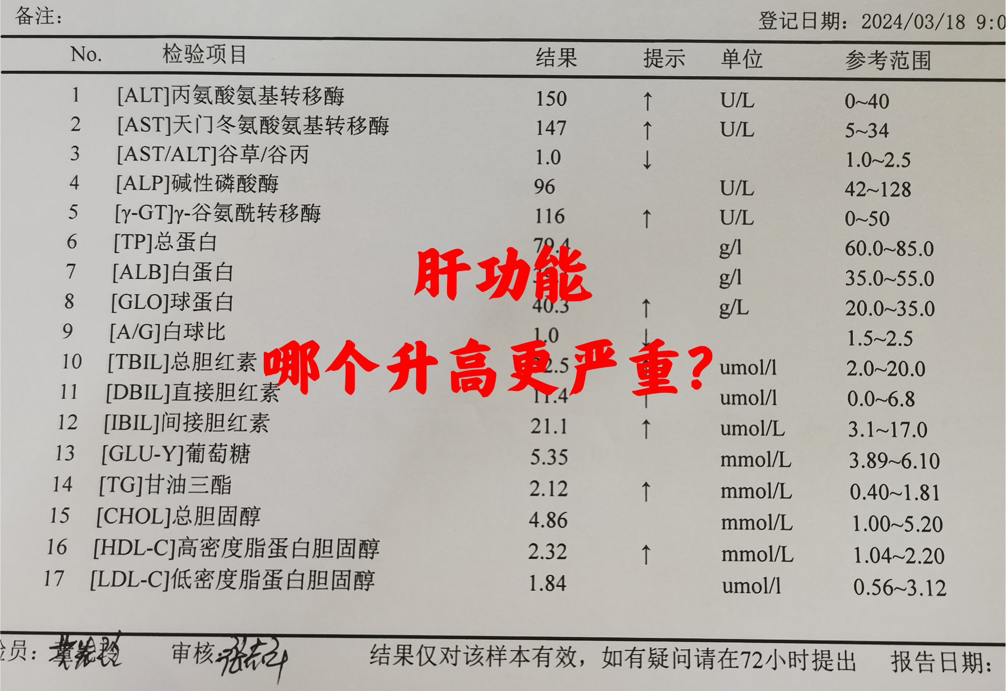 如果谷草大 转氨酶检查酒精肝检测报告图片肝功能检验单转氨酶高多少