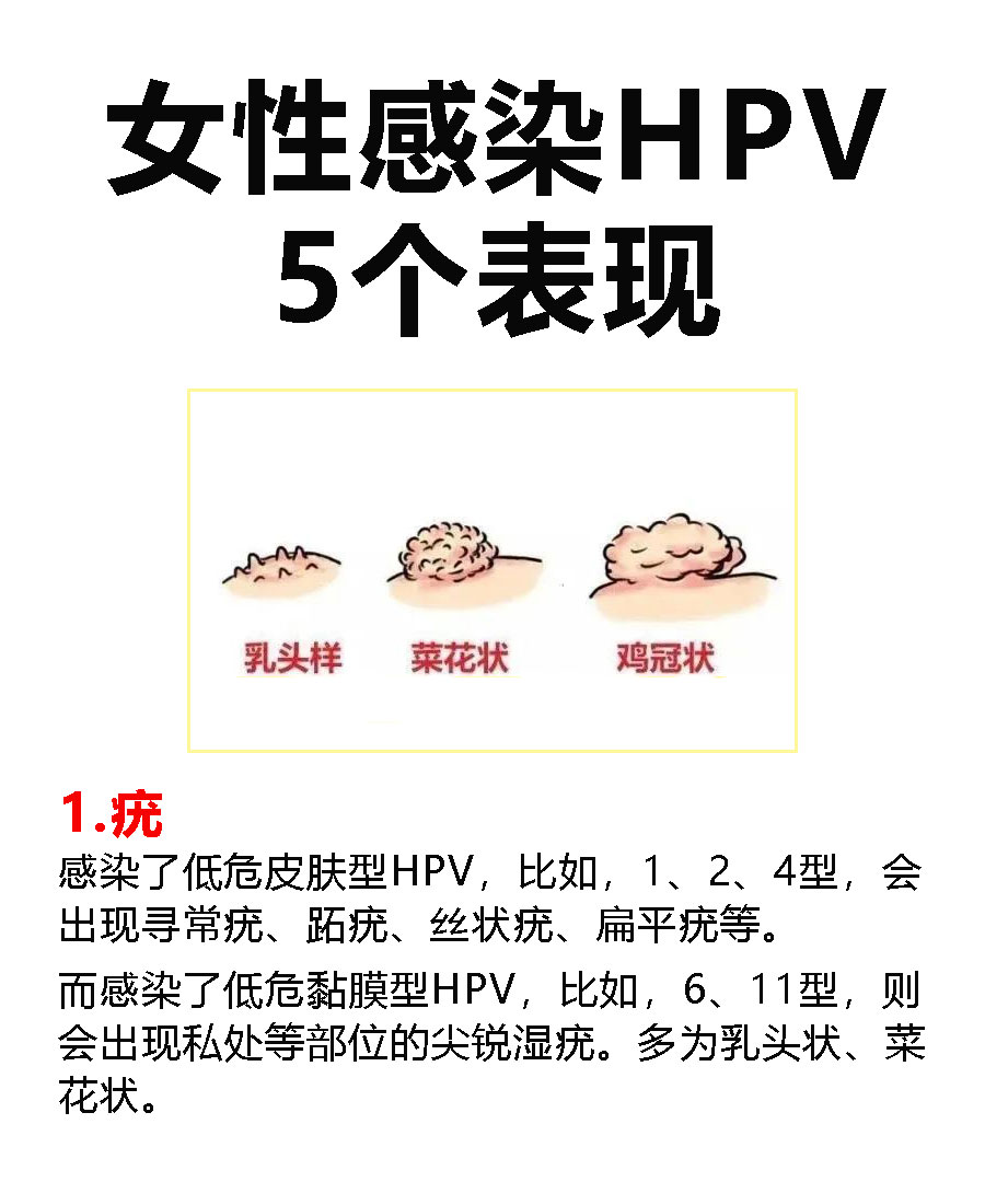 寻常疣会自愈吗图片