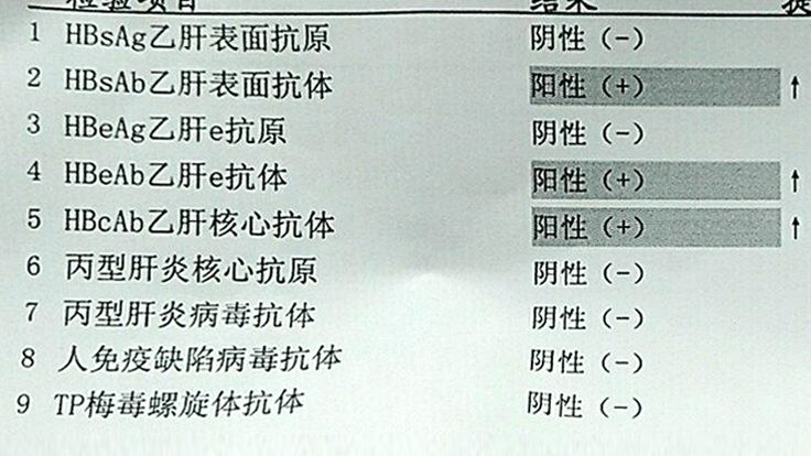 乙肝五项怎么看?