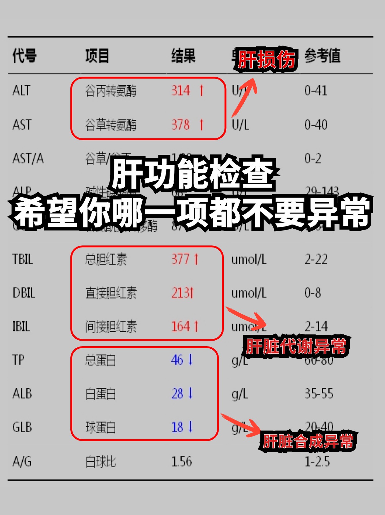 肝功能检查