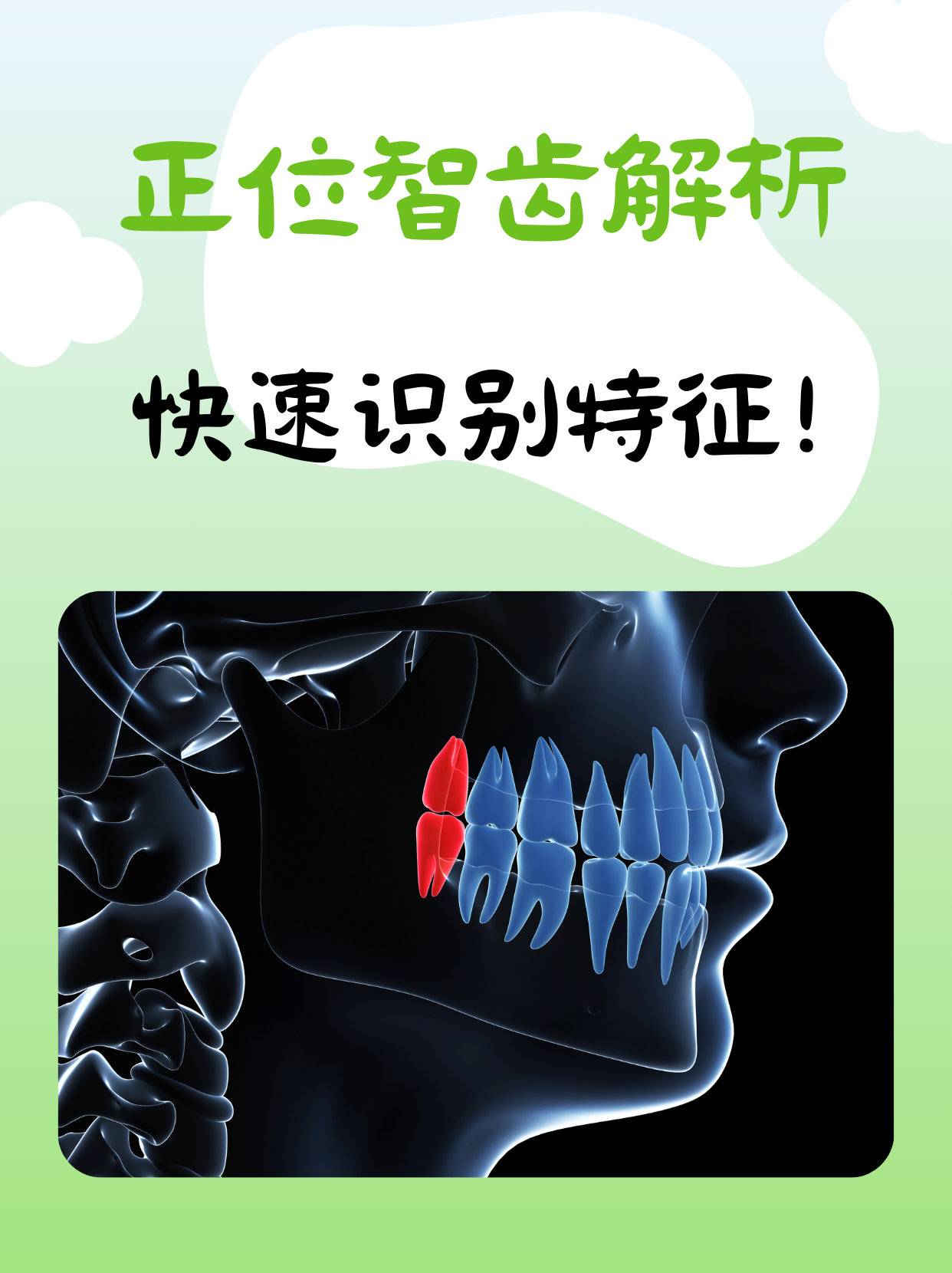 为什么长智齿不疼