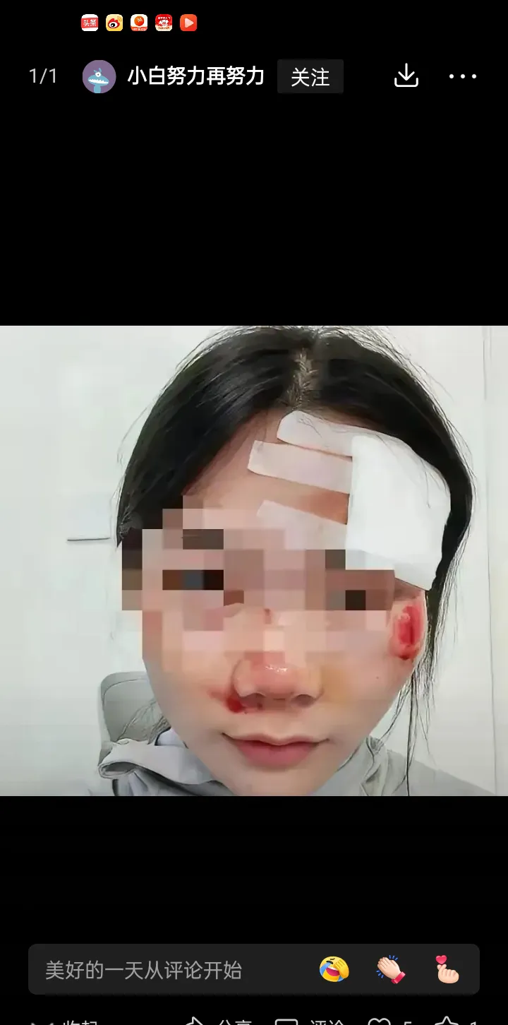今天我发的一个普法小知识被删了,我再发一遍,就