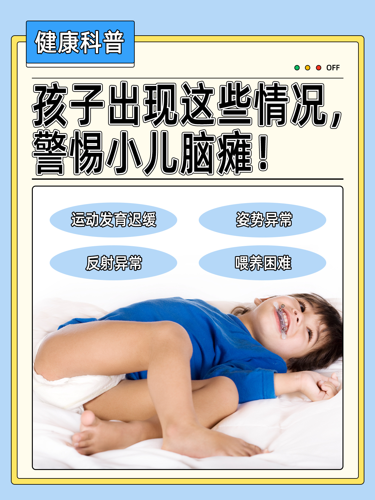 孩子出现这些情况,警惕小儿脑瘫!