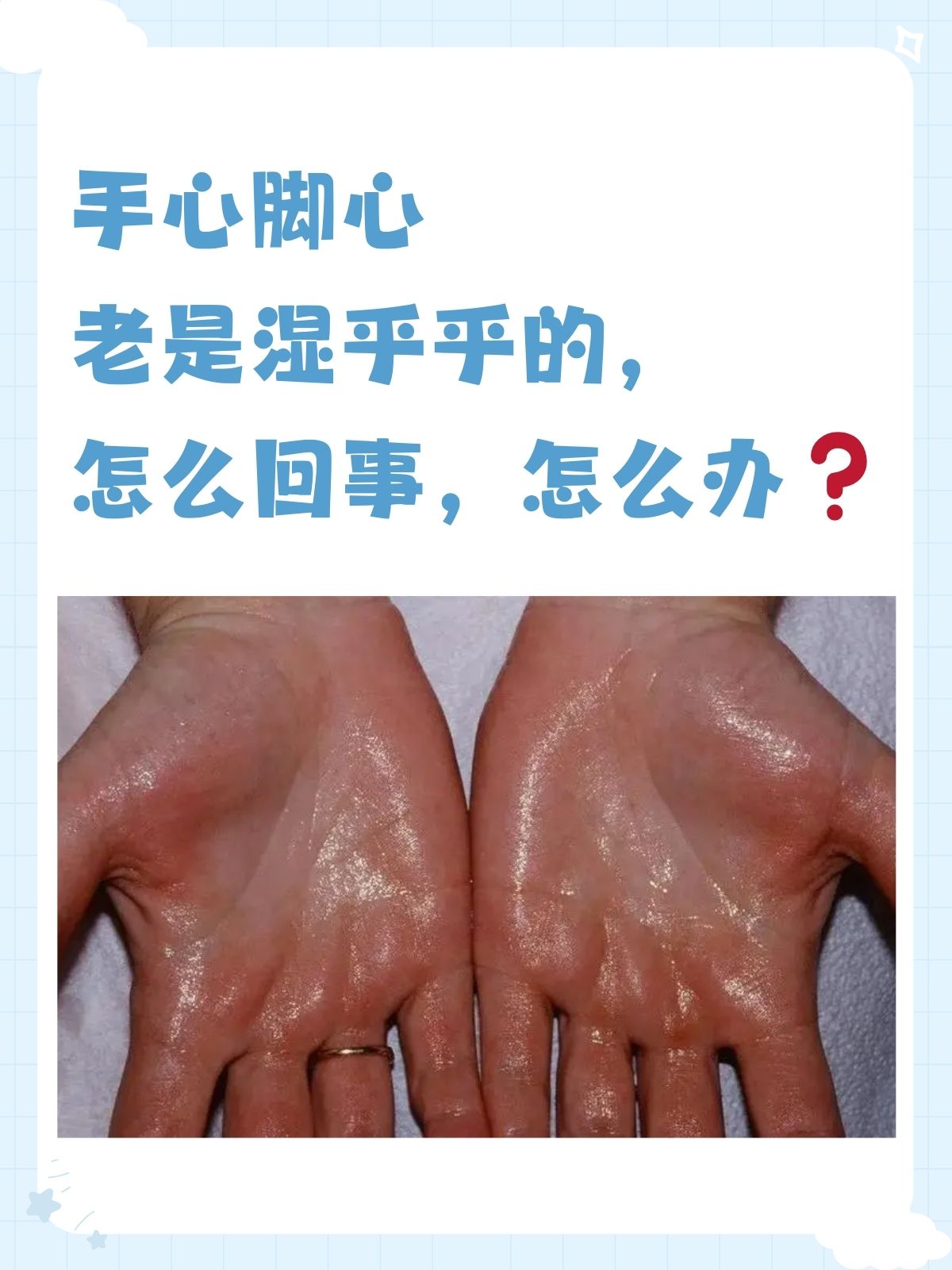 手心脚心老是湿乎乎的,怎么回事,怎么办 手心脚心爱出汗是一种怎样的