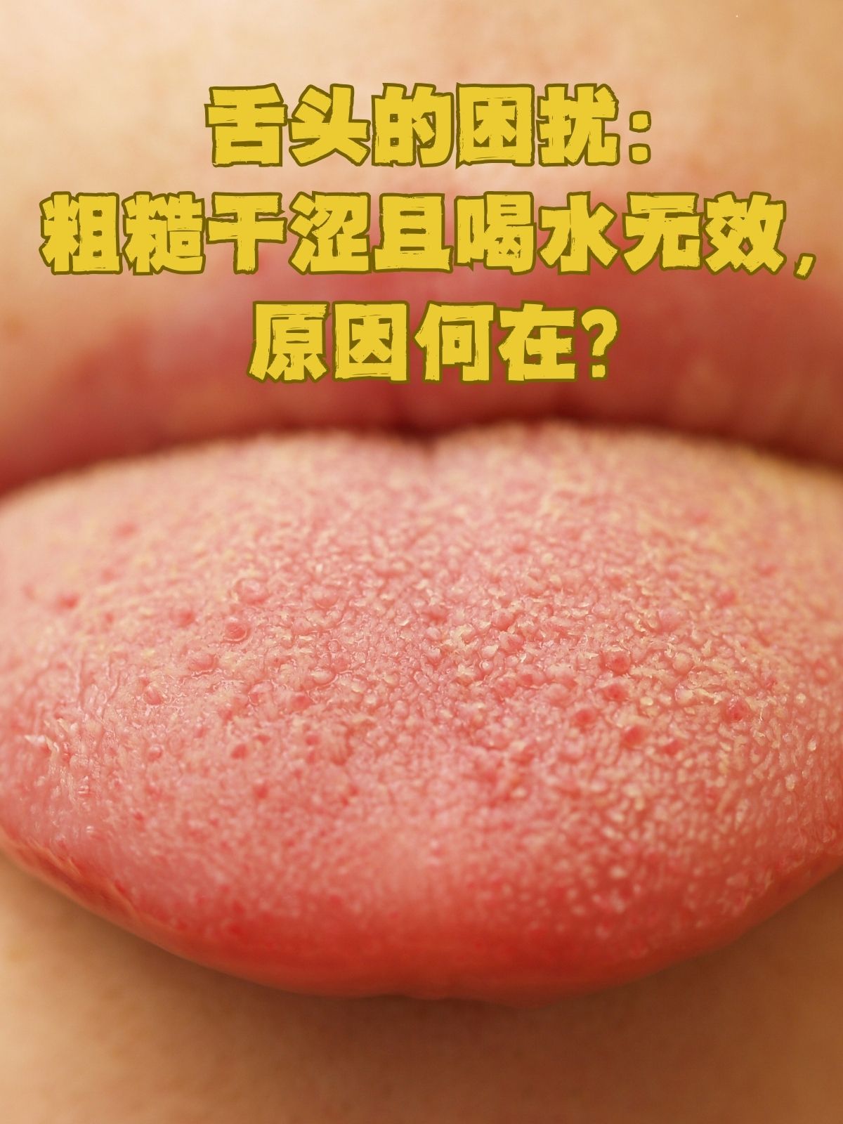 是否曾经有过这样的体验:舌头感觉粗糙干涩,即使喝了很多水也无法