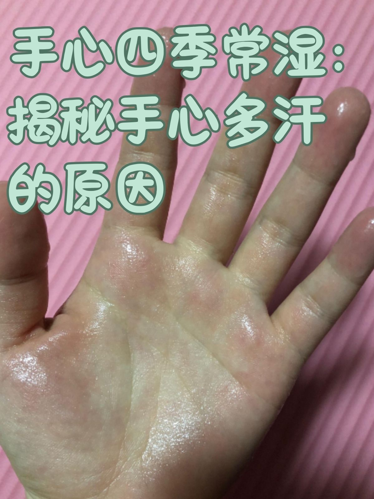 手心四季常湿:揭秘手心多汗的原因 手心出汗在一定程度上是人体的正常