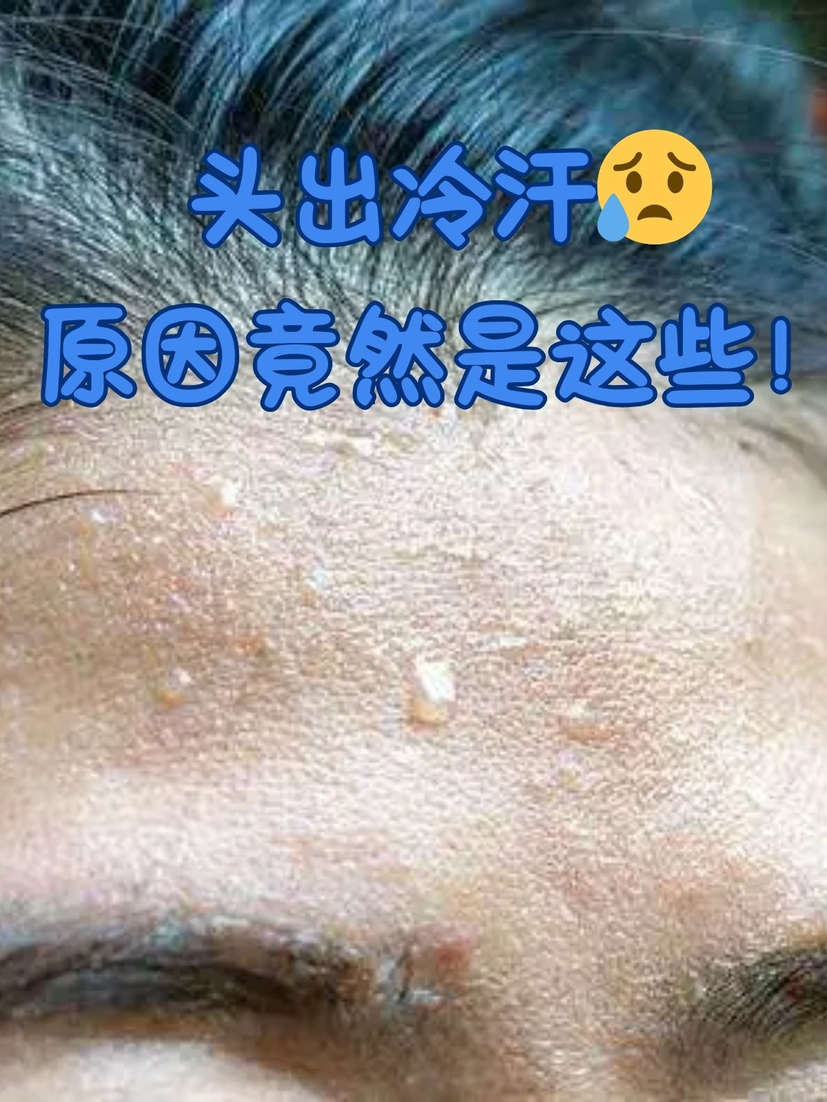 头出冷汗原因竟然是这些
