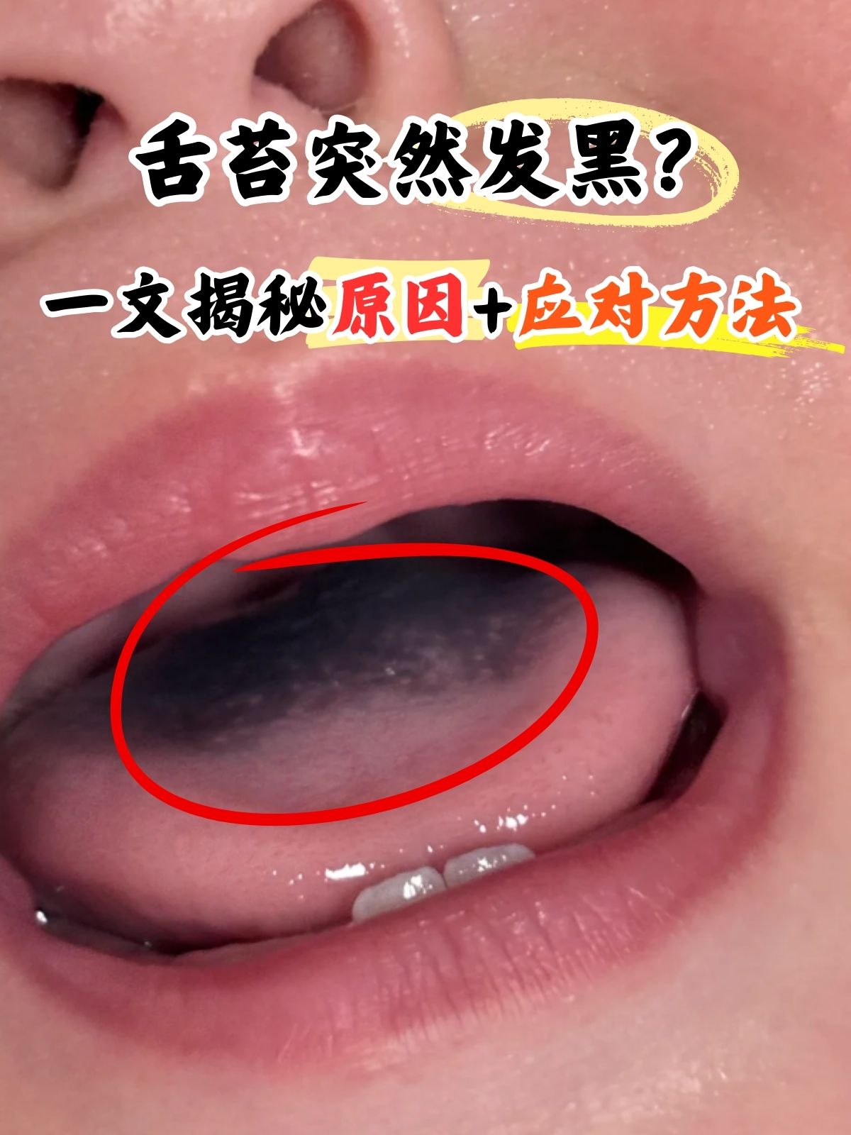 为什么舌头白