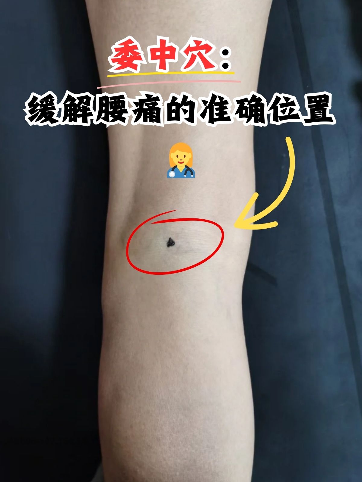 委中穴:缓解腰痛的准确位置 今天我要和大家分享一个中医里非常重要的