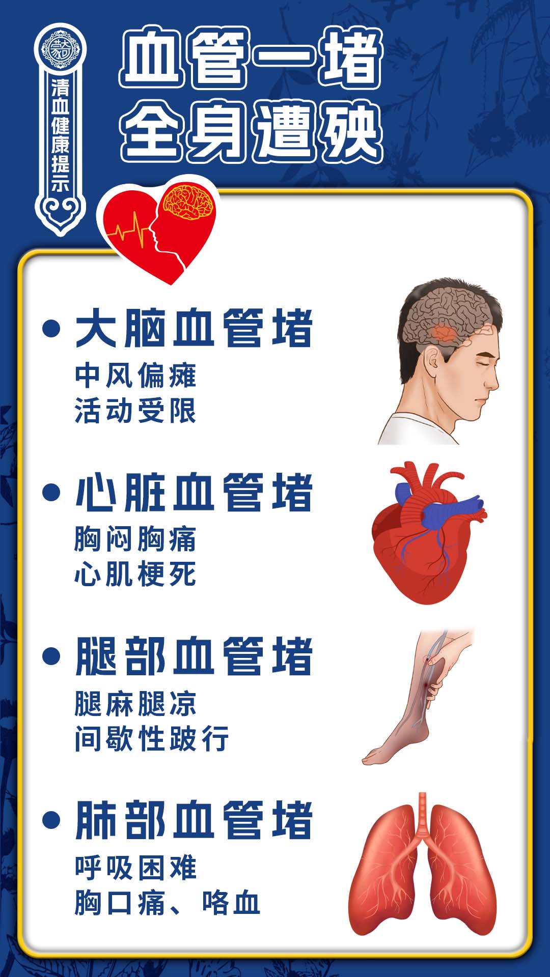脑血管堵塞的5种症状