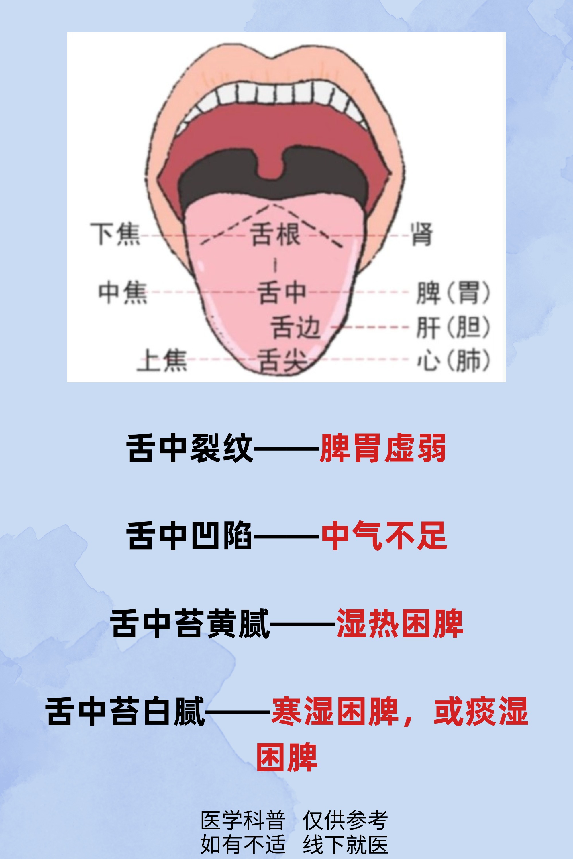 舌苔对应五脏图片图片