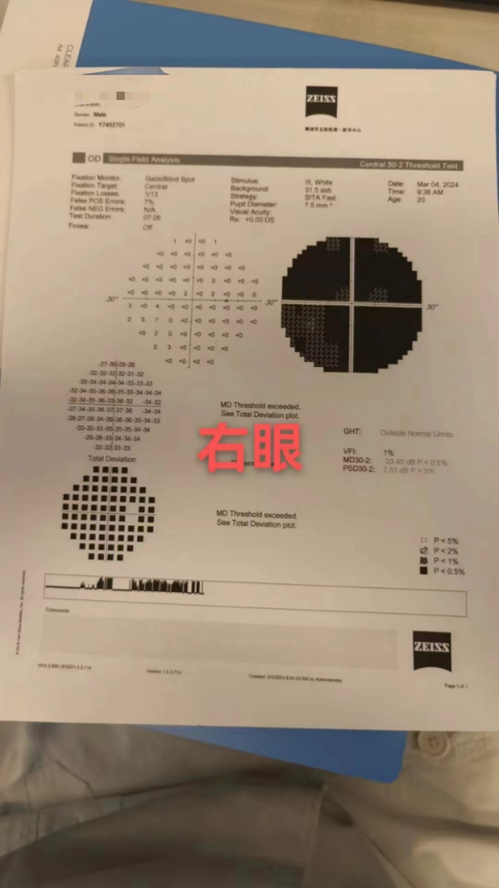 这种青光眼造成的视野缺损能打开吗?