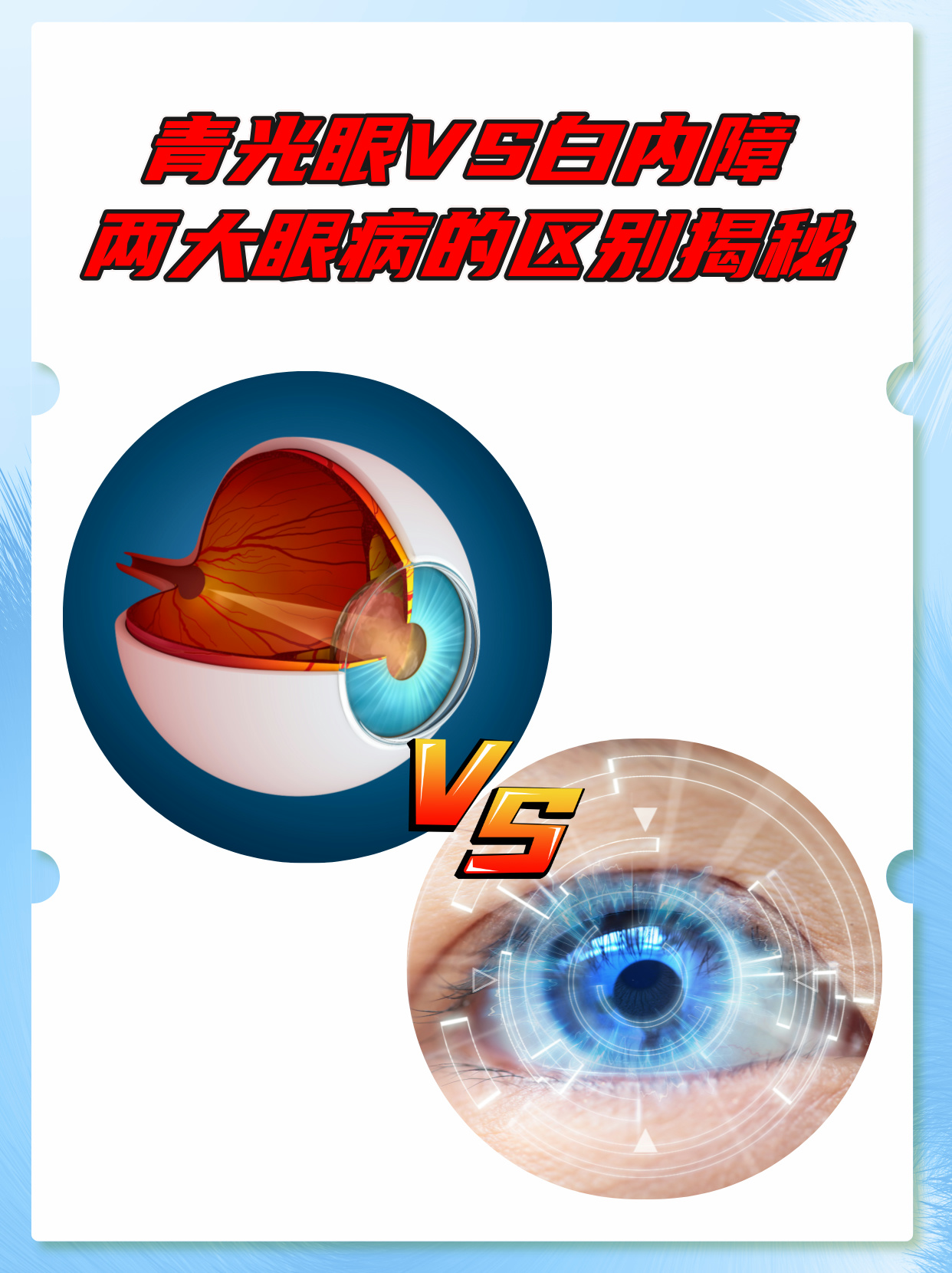 青光眼vs白内障:两大眼病的区别揭秘 青光眼和白内障虽然都是眼睛部位