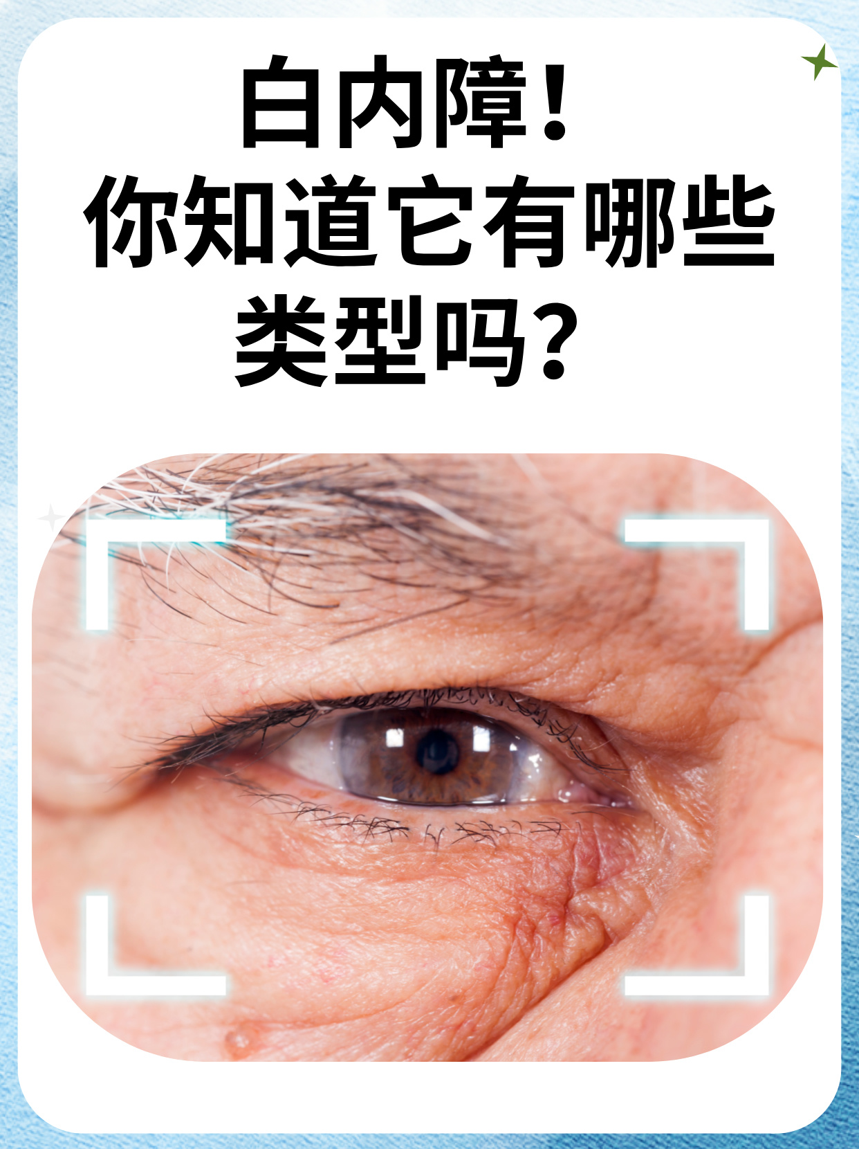 为什么会得白内障