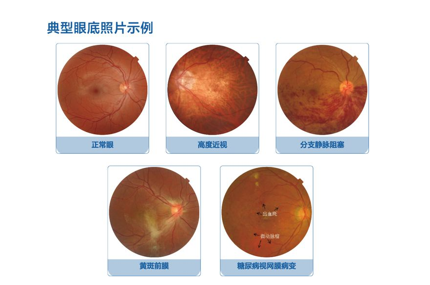 眼球前面的角膜