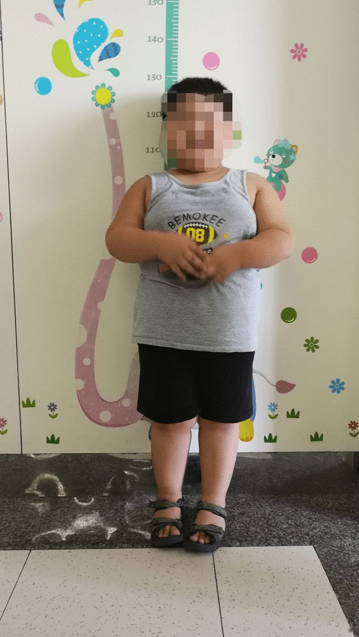 心率偏高  肥胖的孩子在学校被起外号都是次要的,这些健康问题才是重