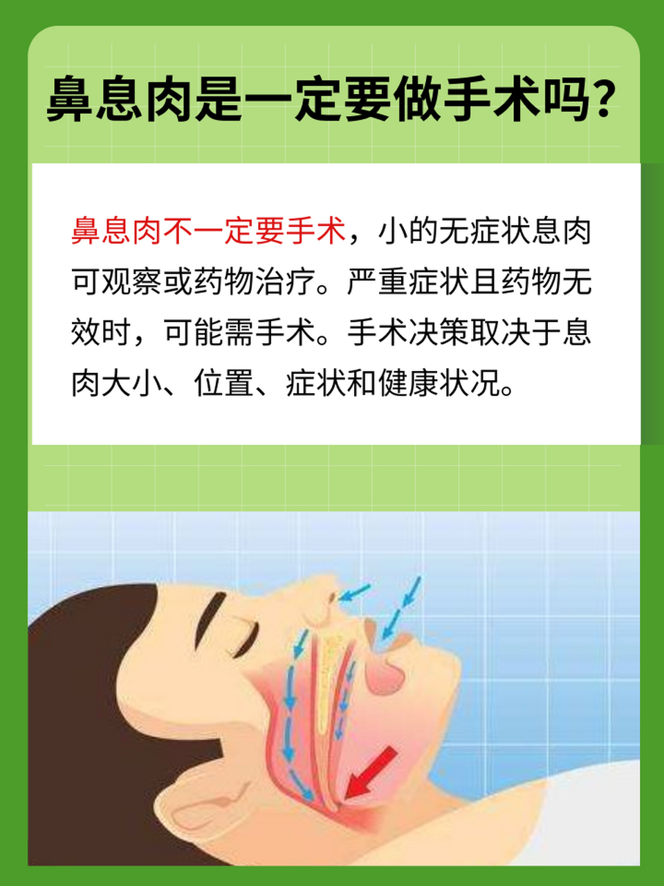 对于小的,无症状的鼻息肉,医生可能会建议观察等待