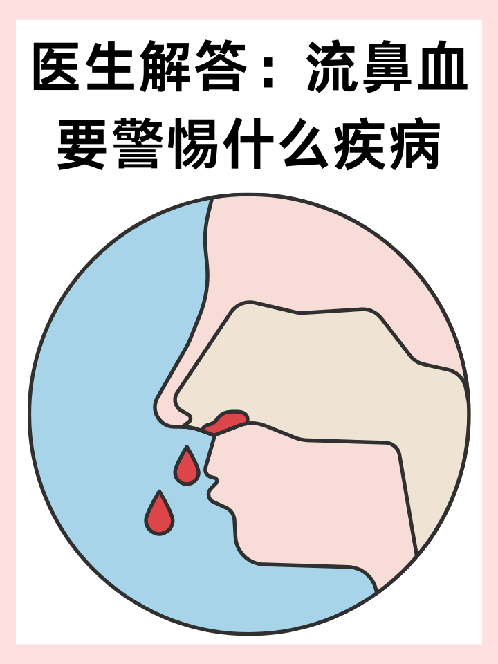 为什么会无缘无故流鼻血 为什么会无缘无故流鼻血