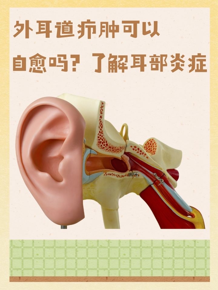 外耳道疖肿,一种常见的耳部感染,常常让人感到不适和