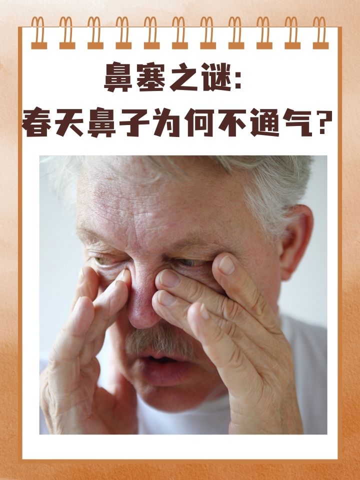 春天的气息渐渐浓郁,万物复苏的同时,很多人却发现自己经常鼻子不