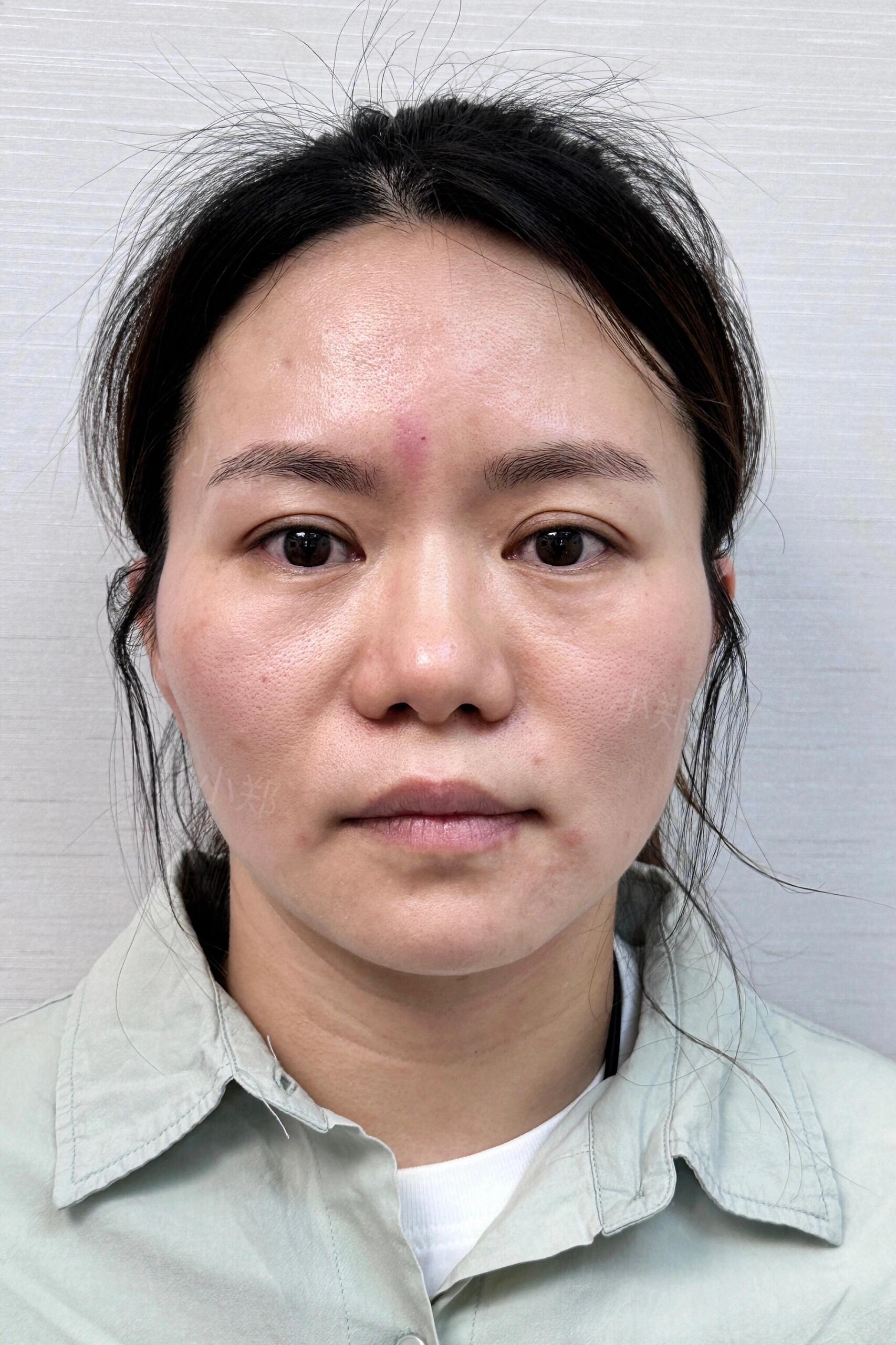 我又期待他的反应,又有点紧张他会说我 (照片经过求美者同意) #抗衰老