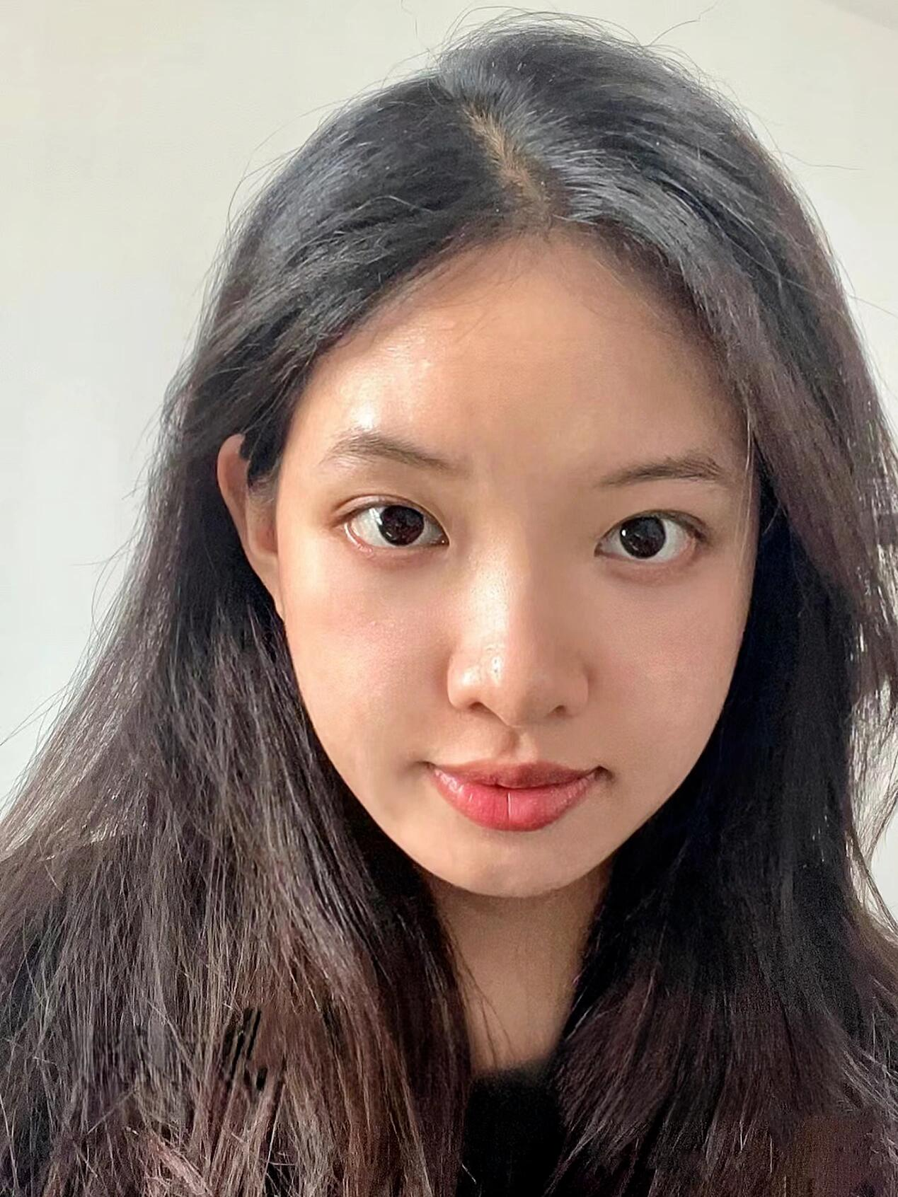 85年的我初次医美,花了40分钟做微调,老公说我"满